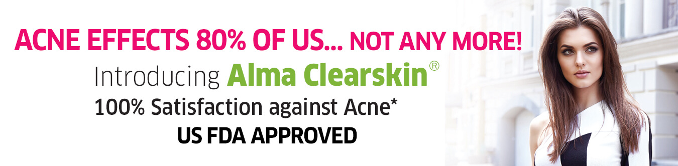 Acne-Alma-Clearskin-Laser