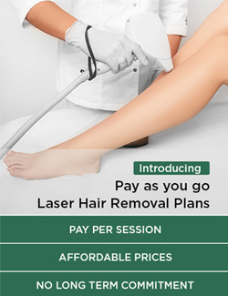 Laser hair removal