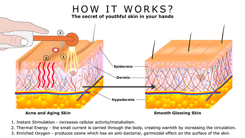 how_it_works_image