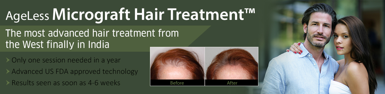 HAIR LOSS TREATMENTS