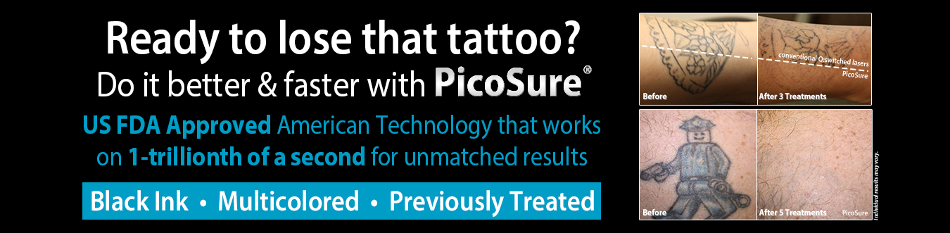 picosure-tattoo